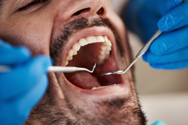 Best Emergency Treatment for Oral Infections in Springfield, NE